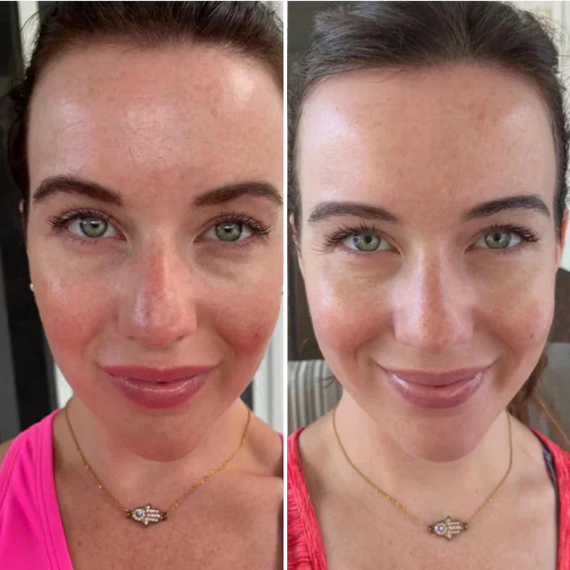 Brightens complexion