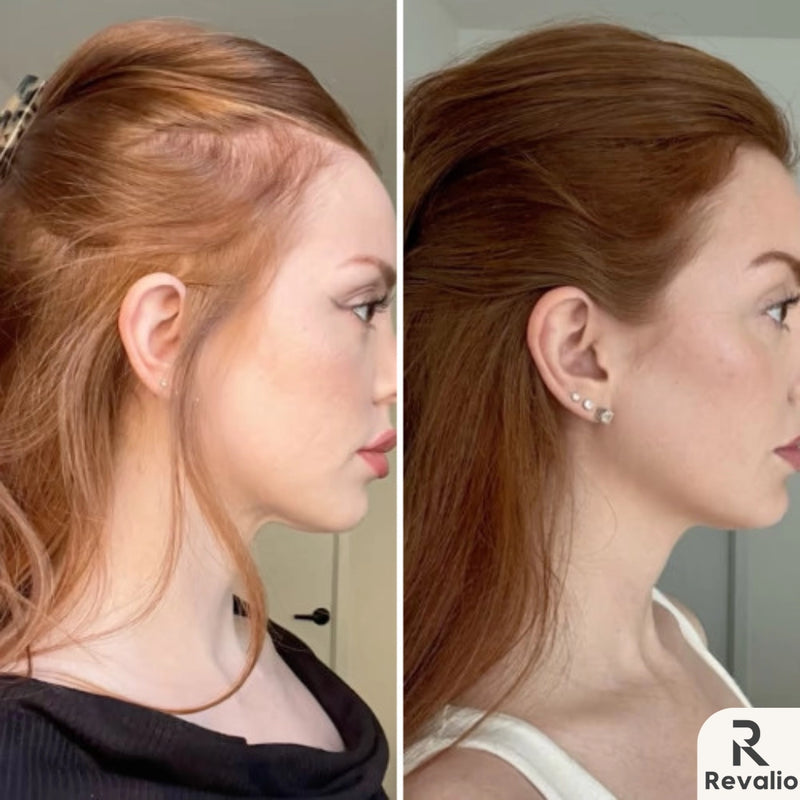 Healthier-Looking Hair Over Time