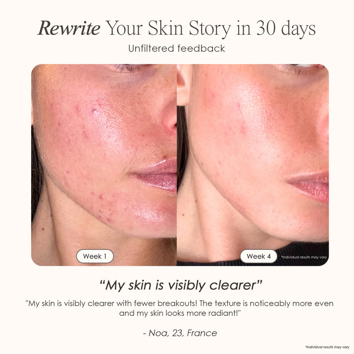 Woman displaying skin results from Revalio LED Face Mask treatments.