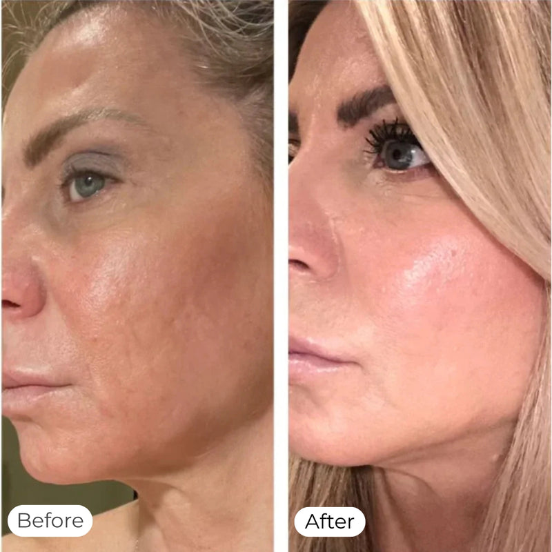 Reduce Fine Lines & Wrinkles