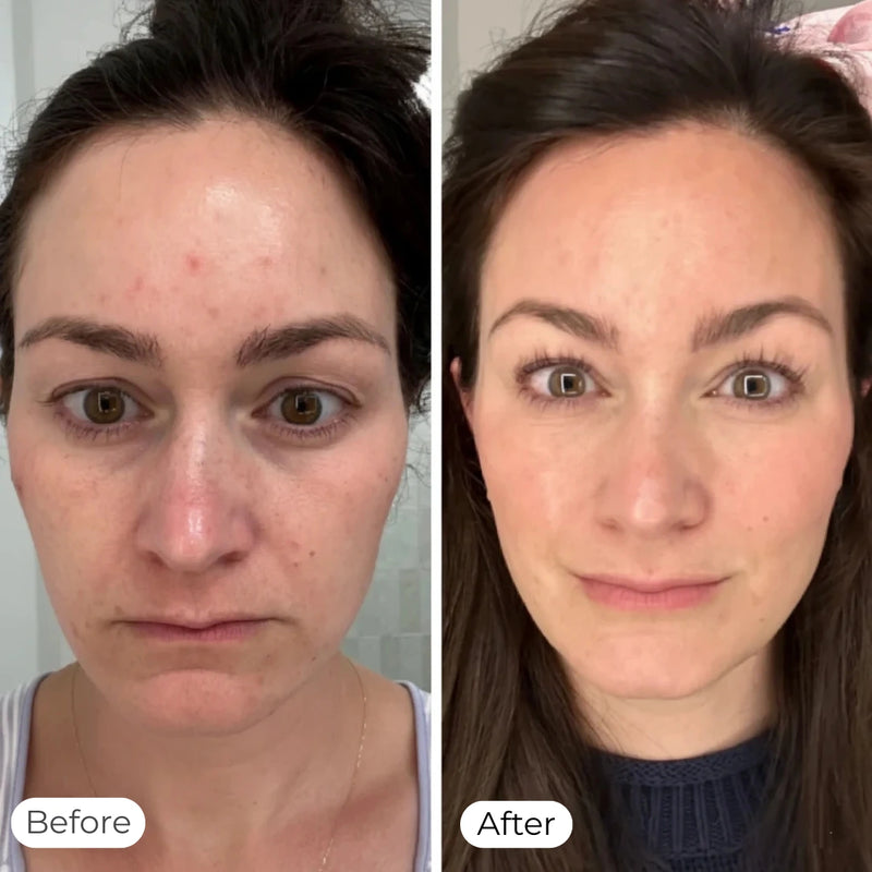 Improve Skin Quality