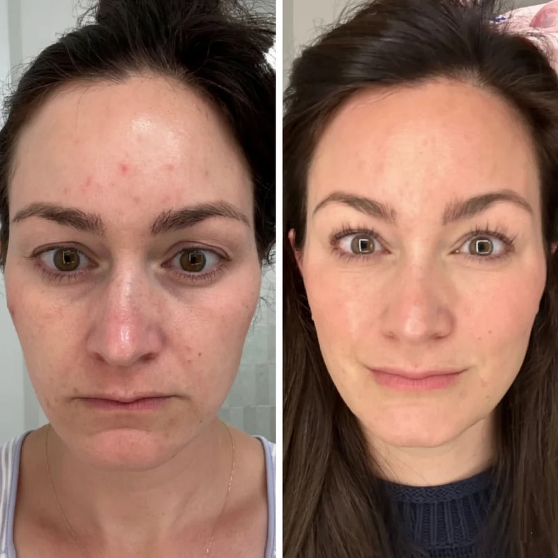 Improve Skin Quality