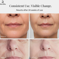 Revalio LED Face Mask